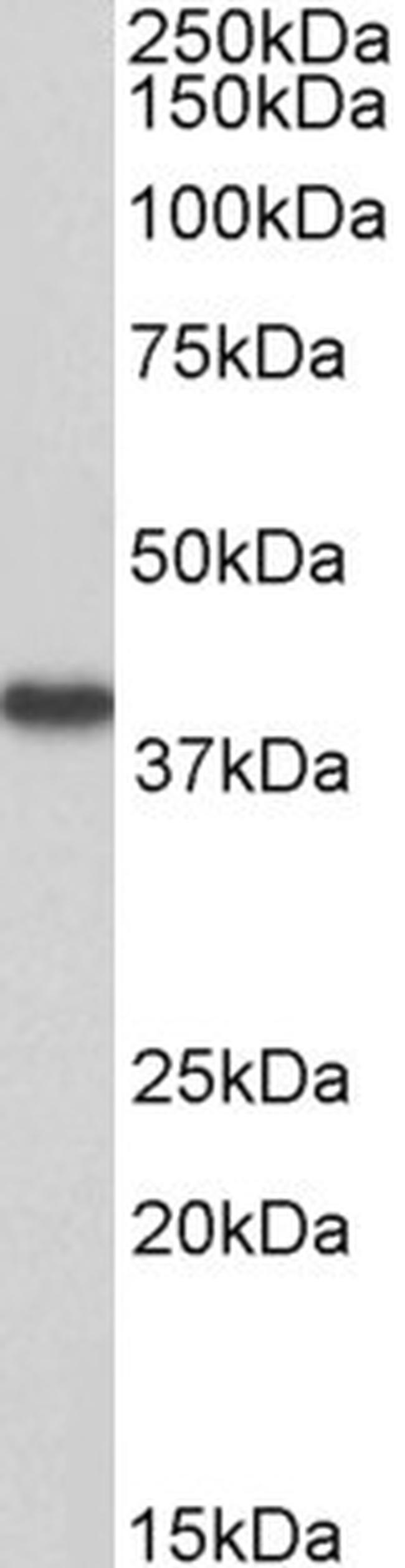 HAO2 Antibody in Western Blot (WB)