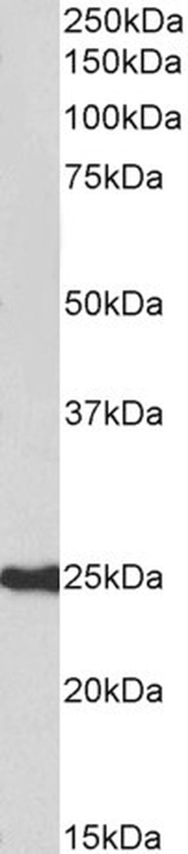 HDGFRP3 Antibody in Western Blot (WB)