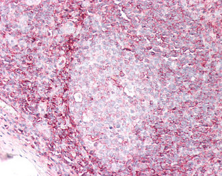 HLA-B Antibody in Immunohistochemistry (Paraffin) (IHC (P))