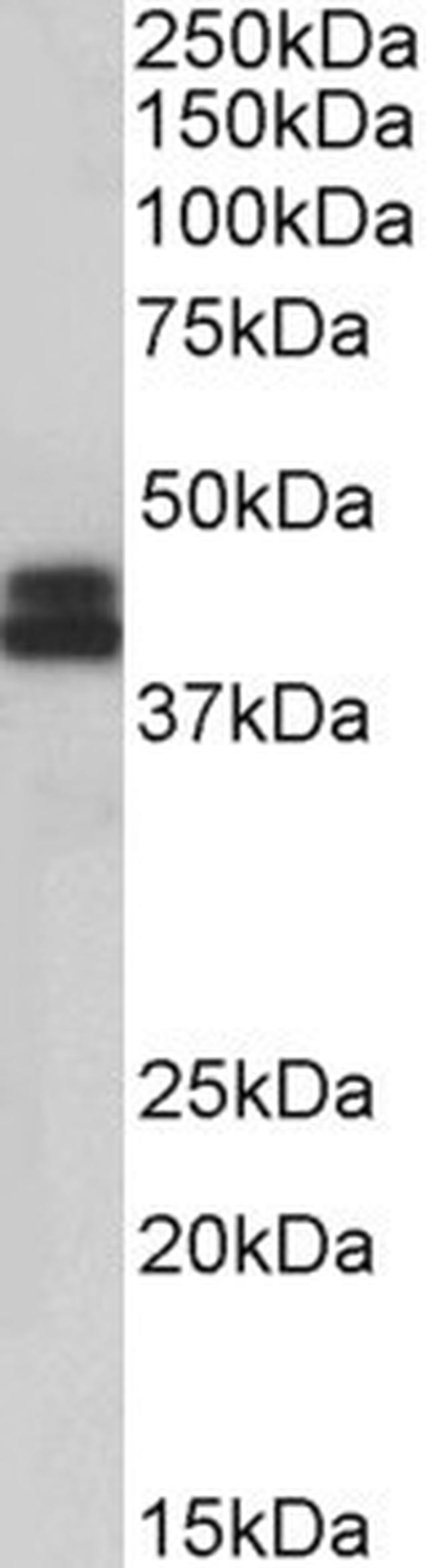 HLA-B Antibody in Western Blot (WB)