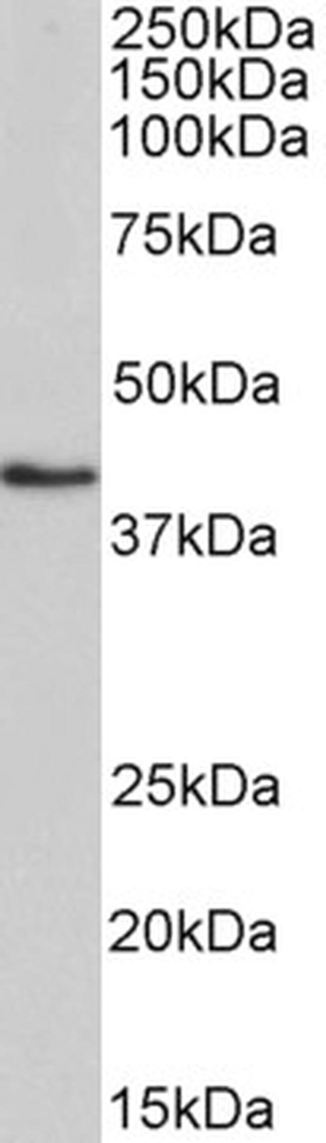 HMBS Antibody in Western Blot (WB)