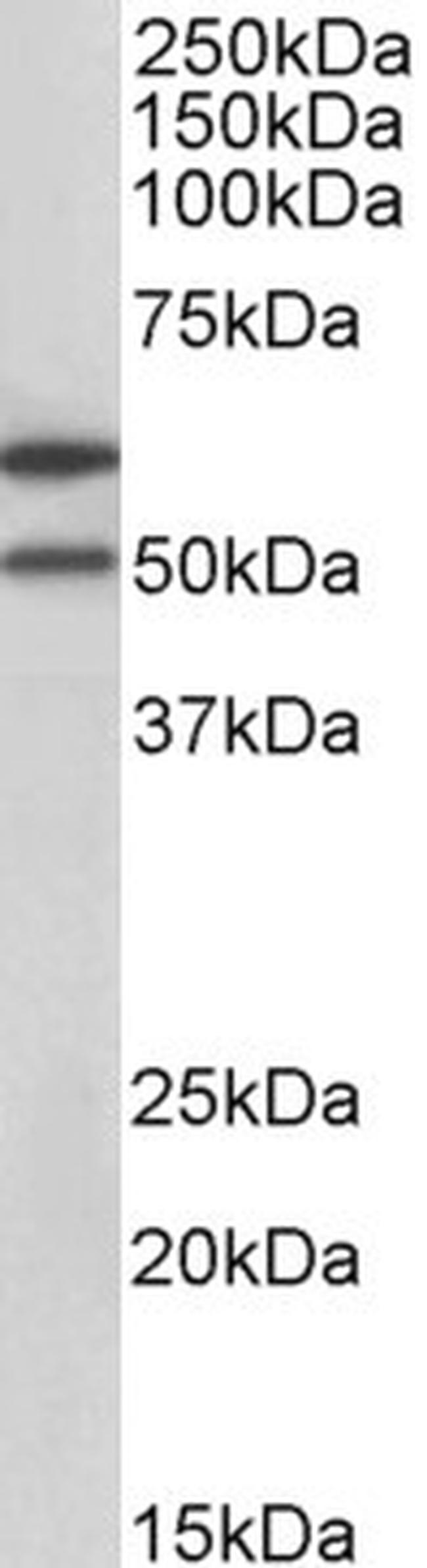 IL13RA2 Antibody in Western Blot (WB)