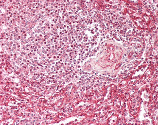 IFITM3 Antibody in Immunohistochemistry (Paraffin) (IHC (P))