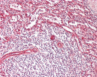 IFITM3 Antibody in Immunohistochemistry (Paraffin) (IHC (P))