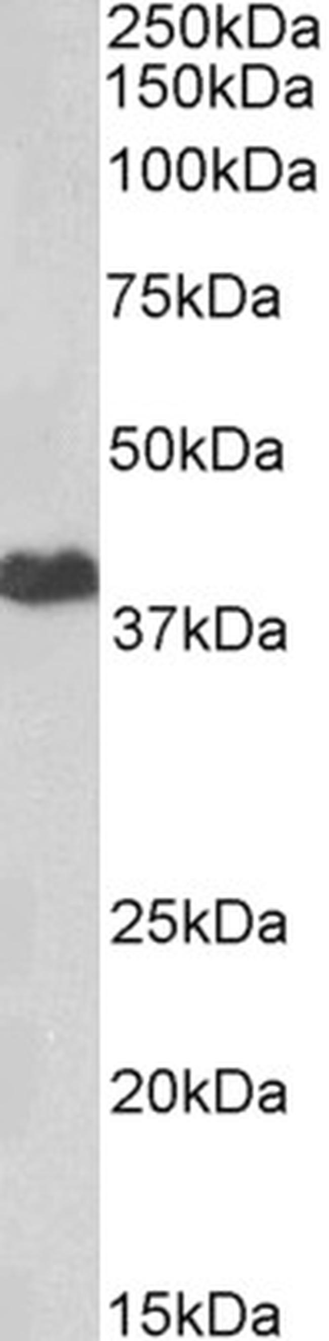 PKA alpha Antibody in Western Blot (WB)