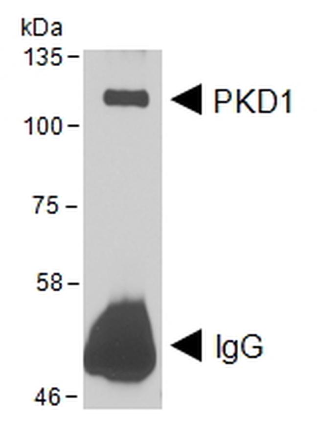 PKC mu Antibody in Western Blot (WB)