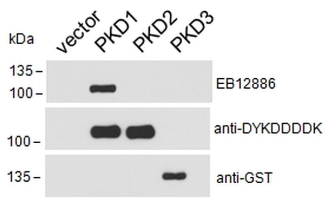 PKC mu Antibody in Western Blot (WB)