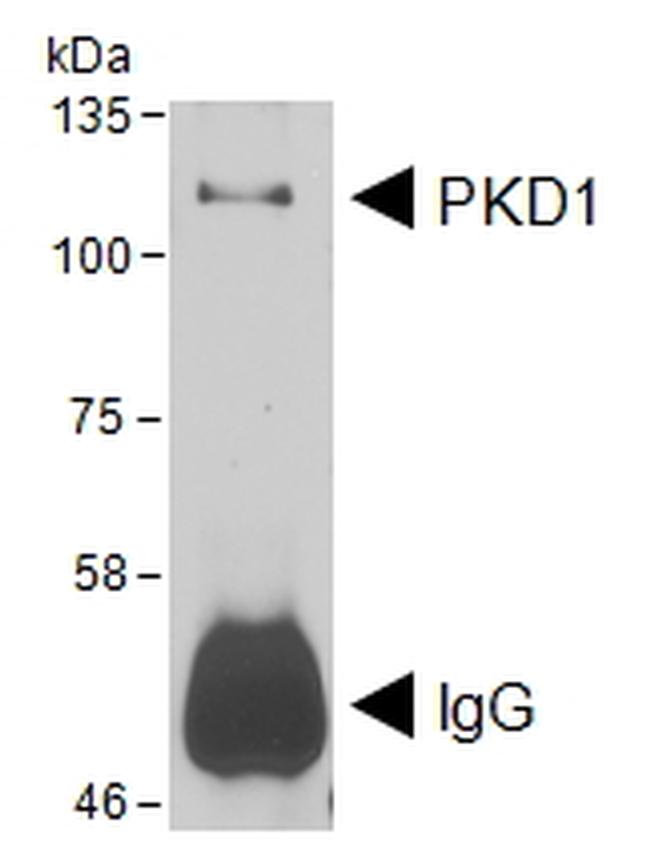 PKC mu Antibody in Western Blot (WB)