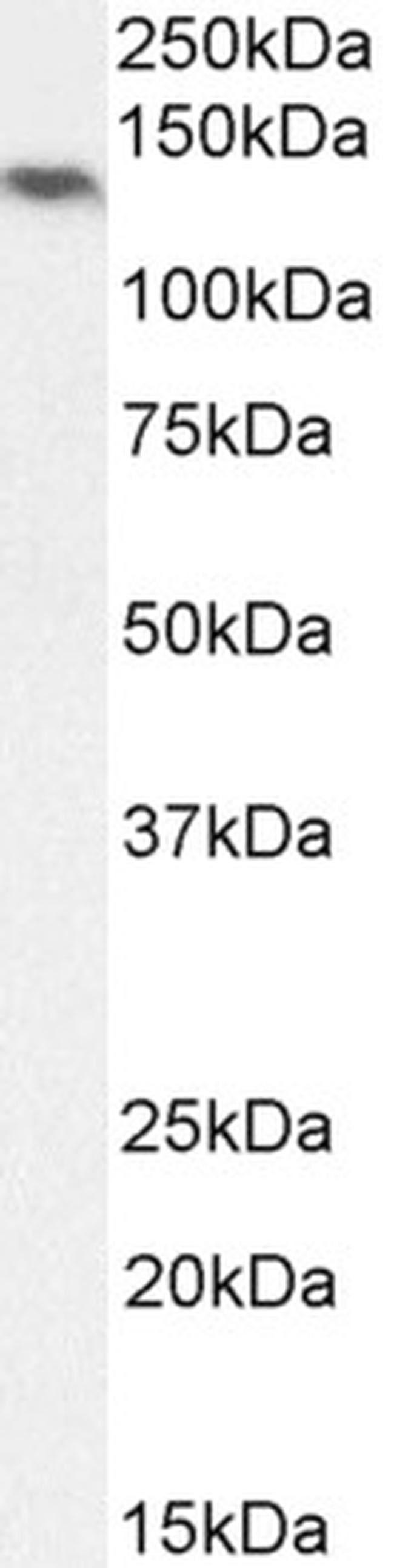 NALP5 Antibody in Western Blot (WB)