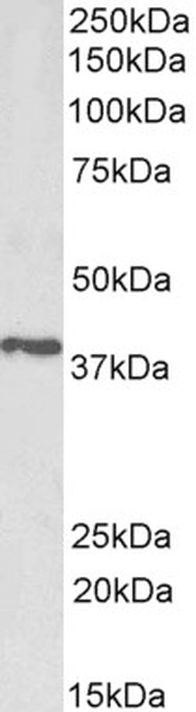 PTGR2 Antibody in Western Blot (WB)