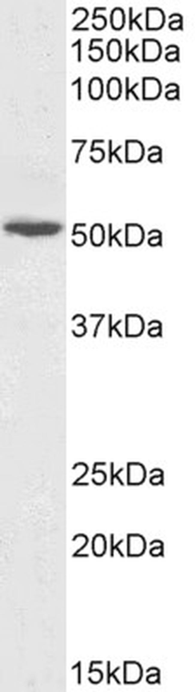 GPT Antibody in Western Blot (WB)