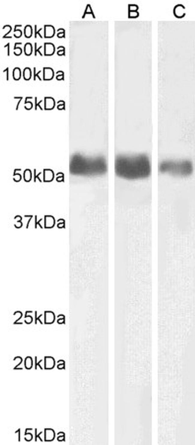 ALPL Antibody in Western Blot (WB)