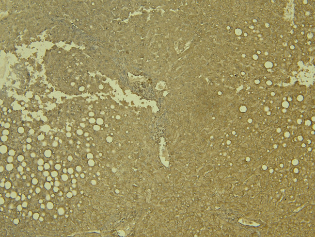 LCAT Antibody in Immunohistochemistry (Paraffin) (IHC (P))