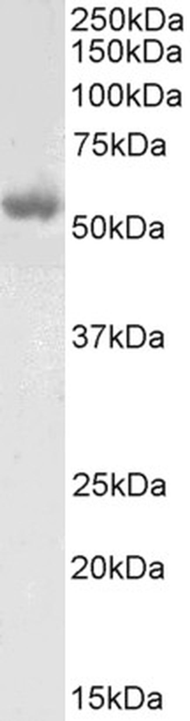 LCAT Antibody in Western Blot (WB)