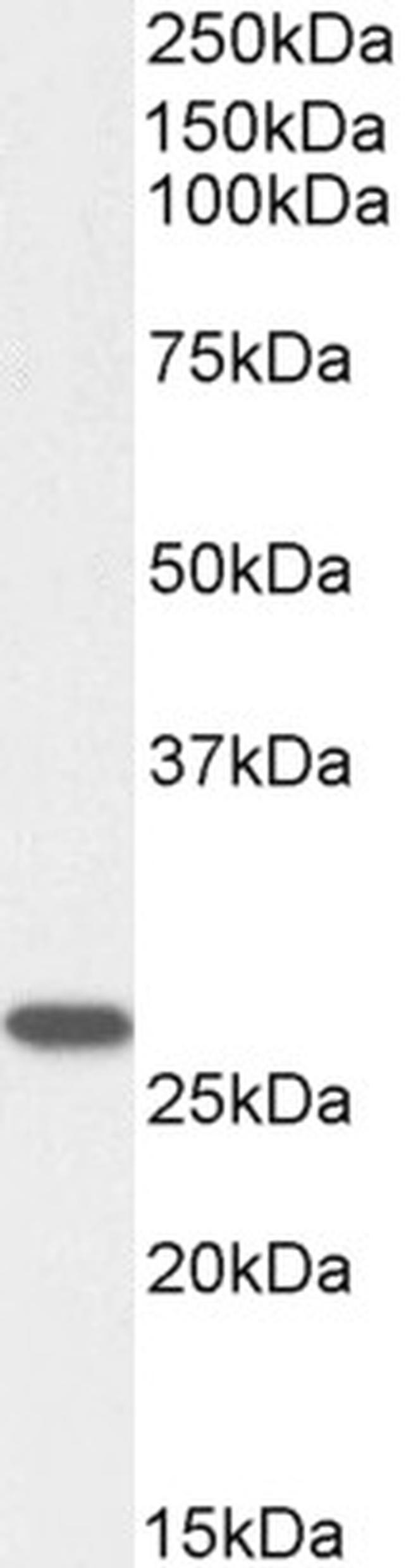 GSTM4 Antibody in Western Blot (WB)