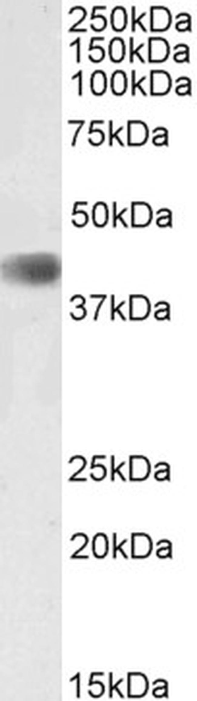 CDK9 Antibody in Western Blot (WB)