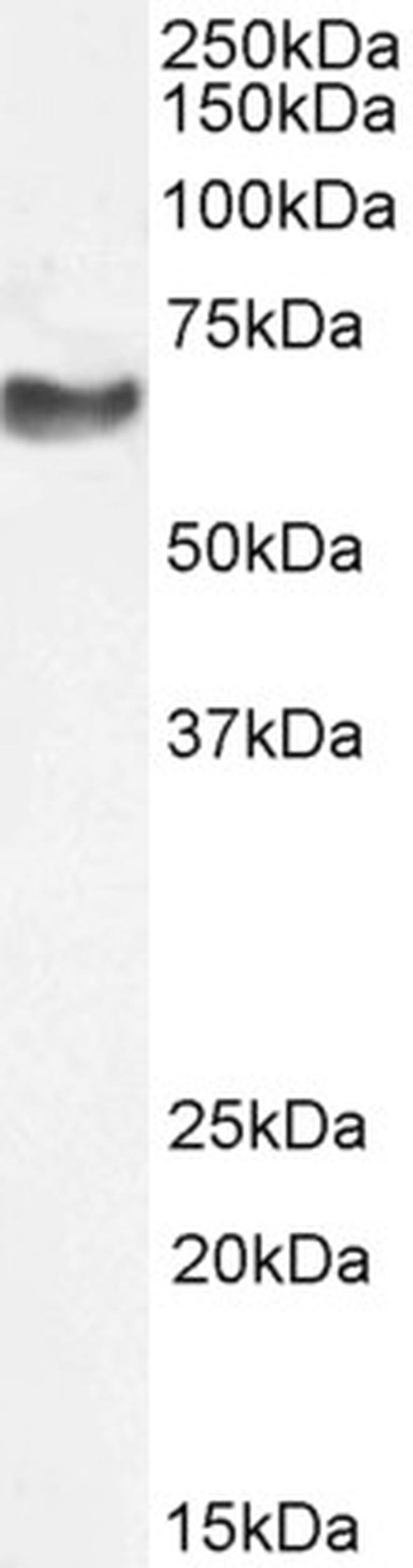 NEFL Antibody in Western Blot (WB)