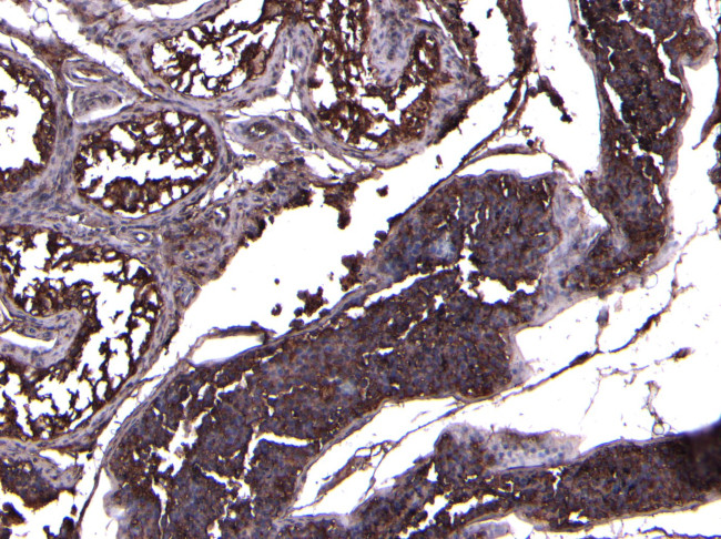 ACE2 Antibody in Immunohistochemistry (Paraffin) (IHC (P))