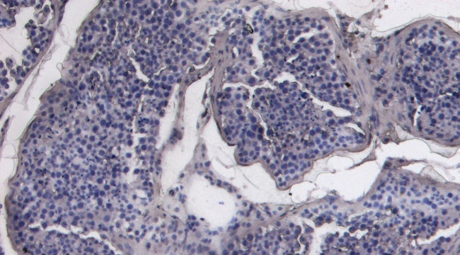 ACE2 Antibody in Immunohistochemistry (Paraffin) (IHC (P))