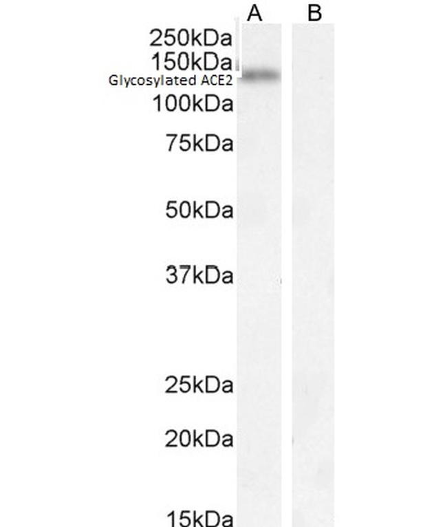 ACE2 Antibody in Western Blot (WB)