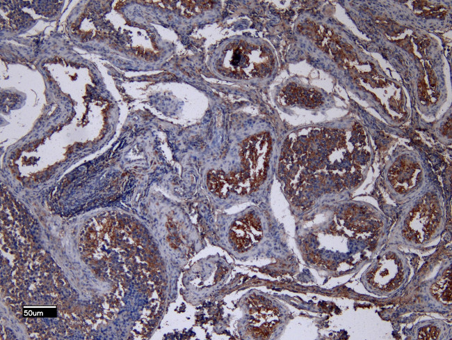 ACE2 Antibody in Immunohistochemistry (Paraffin) (IHC (P))