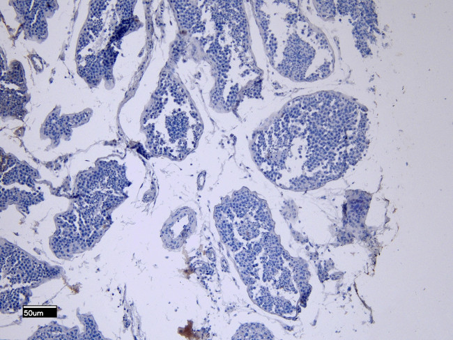 ACE2 Antibody in Immunohistochemistry (Paraffin) (IHC (P))