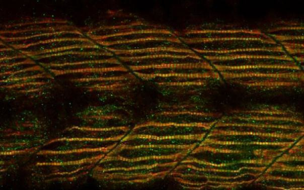 Cardiac Troponin C Antibody in Immunohistochemistry (PFA fixed) (IHC (PFA))