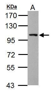 Thrombospondin 4 Antibody in Western Blot (WB)