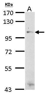 Thrombospondin 4 Antibody in Western Blot (WB)