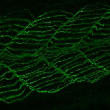 Dynamin 2 Antibody in Immunohistochemistry (PFA fixed) (IHC (PFA))