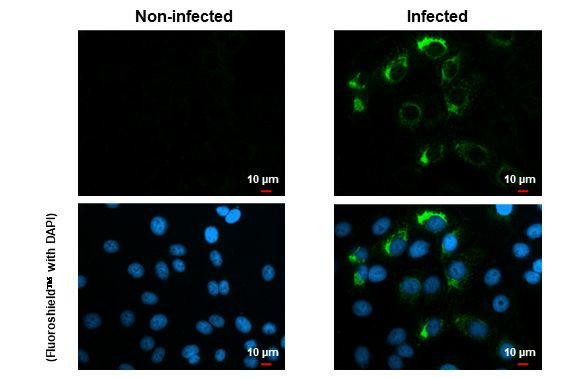 Zika Virus NS4B (strain H/PF/2013) Antibody in Immunocytochemistry (ICC/IF)