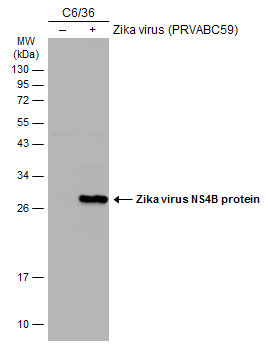 Zika Virus NS4B (strain H/PF/2013) Antibody in Western Blot (WB)