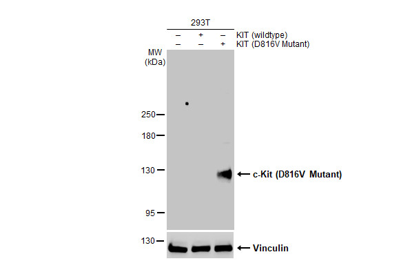 c-Kit (D816V Mutant) Antibody in Western Blot (WB)