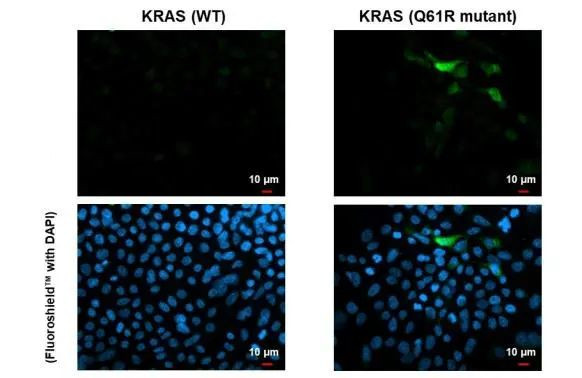 K-Ras (Q61R Mutant) Antibody in Immunocytochemistry (ICC/IF)