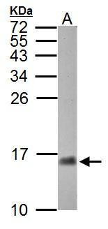 CRABP2 Antibody in Western Blot (WB)