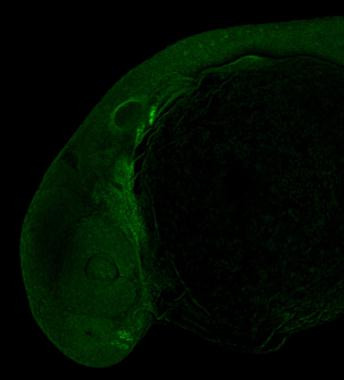 DLX2 Antibody in Immunohistochemistry (PFA fixed) (IHC (PFA))