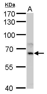 CYP1A1 Antibody in Western Blot (WB)