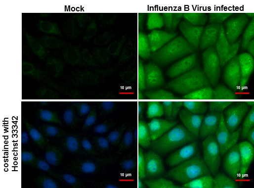 Influenza B NP (B/Taiwan/753/2005) Antibody in Immunocytochemistry (ICC/IF)