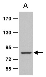 ZRANB1b Antibody in Western Blot (WB)