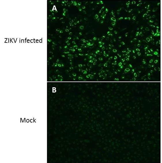 Zika Virus NS1 (strain H/PF/2013) Antibody in Immunocytochemistry (ICC/IF)