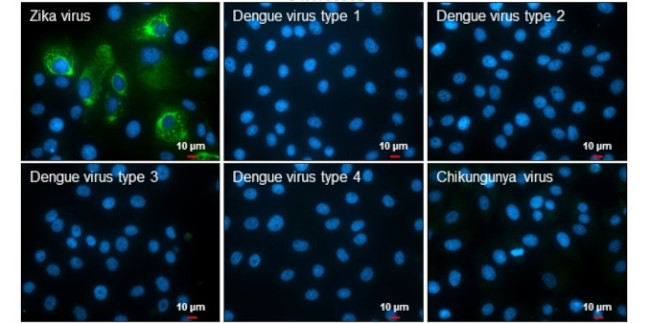 Zika Virus NS2B (strain H/PF/2013) Antibody in Immunocytochemistry (ICC/IF)