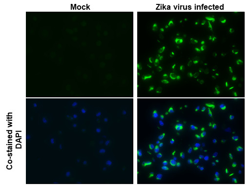 Zika Virus NS2B (strain H/PF/2013) Antibody in Immunocytochemistry (ICC/IF)