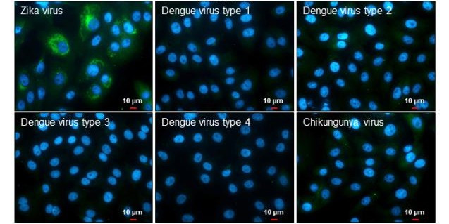 Zika Virus NS3 (strain H/PF/2013) Antibody in Immunocytochemistry (ICC/IF)