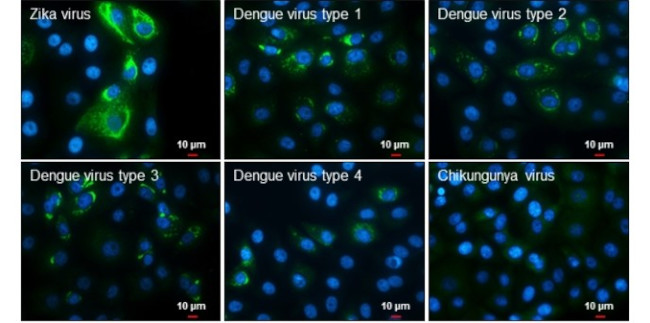 Zika Virus NS4B (strain H/PF/2013) Antibody in Immunocytochemistry (ICC/IF)