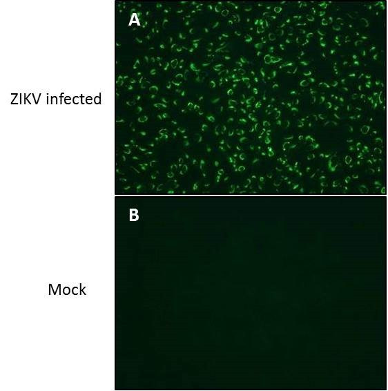 Zika Virus NS4B (strain H/PF/2013) Antibody in Immunocytochemistry (ICC/IF)