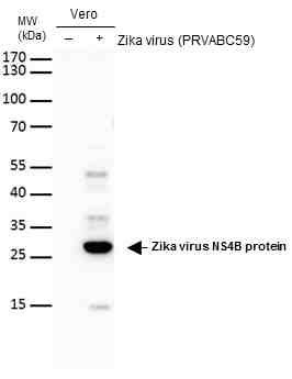 Zika Virus NS4B (strain H/PF/2013) Antibody in Western Blot (WB)