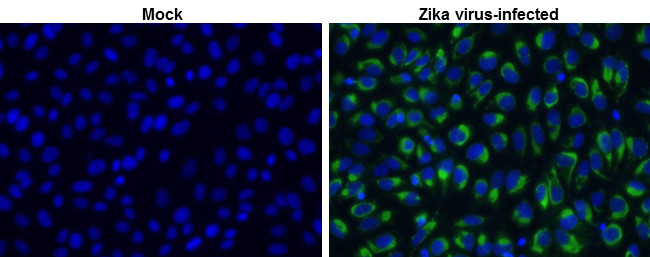 Zika Virus NS2B (strain H/PF/2013) Antibody in Immunocytochemistry (ICC/IF)