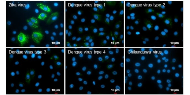 Zika Virus Envelope (strain H/PF/2013) Antibody in Immunocytochemistry (ICC/IF)