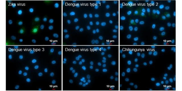 Zika Virus NS5 (strain H/PF/2013) Antibody in Immunocytochemistry (ICC/IF)