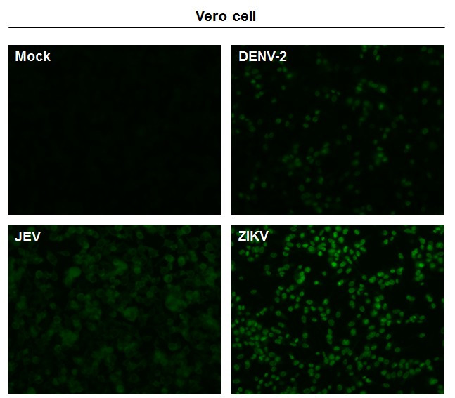 Zika Virus NS5 (strain H/PF/2013) Antibody in Immunocytochemistry (ICC/IF)